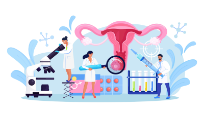 Excetuando-se o câncer de pele não melanoma, o câncer de colo uterino é o terceiro mais frequente na população feminina brasileira (Ilustração: Getty Images)