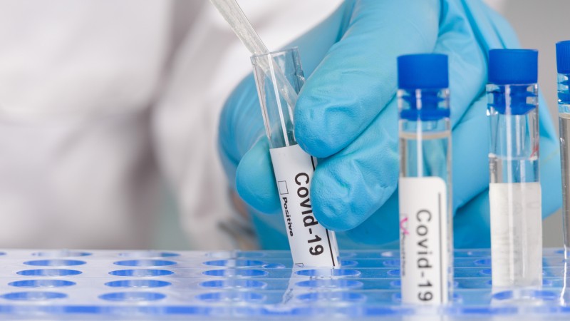 Estudo científico constatou que o uso de hidroxicloroquina (HCQ), prednisona ou ambos causaram redução da hospitalização em 50-60% de pacientes com Covid (Foto: Getty Images)